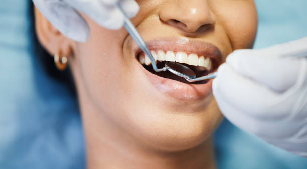 Best Emergency Wisdom Teeth Removal in Mcpherson, KS